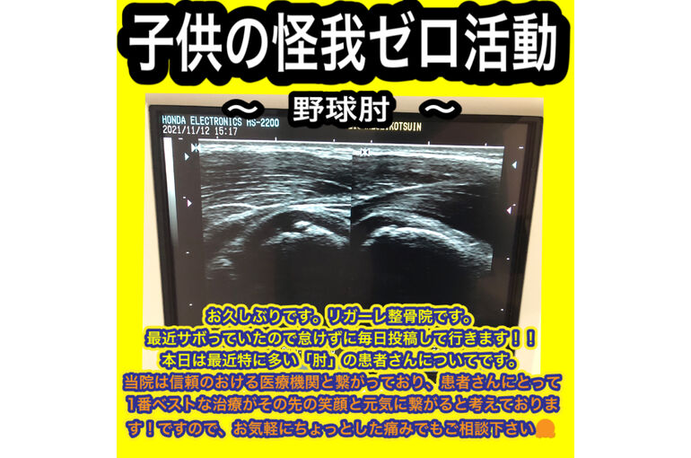 F5B12F1D-18D4-490B-8F27-98BAAD2D3970