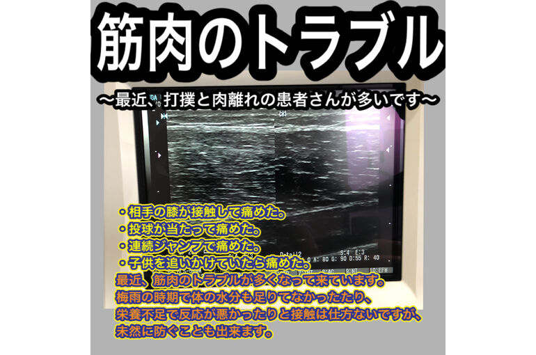 797D4C88-621C-4567-9E07-7D36C87E4E6D