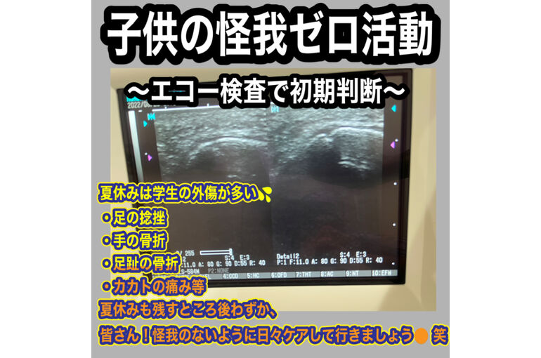 C1C22E7A-6B53-43D0-A218-52D6D127B7FB
