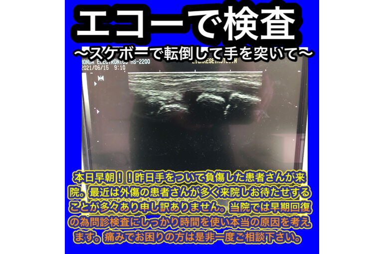 F19DE63F-B1E0-4056-8A09-51103FA9FA8C
