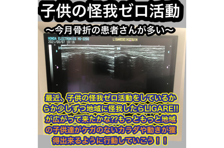 D9BC42DE-E713-434F-A31B-624D7A5FA74C